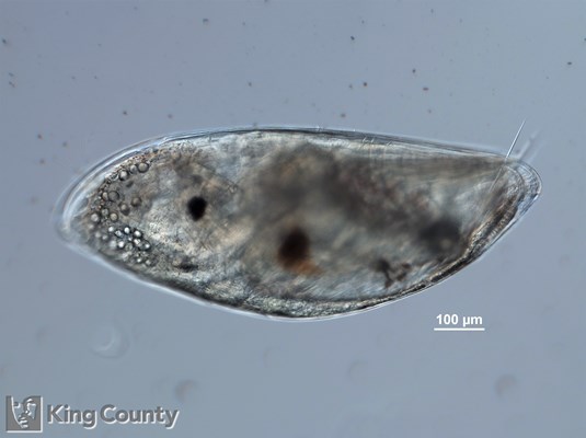 Photo of Cirripedia: larval stages